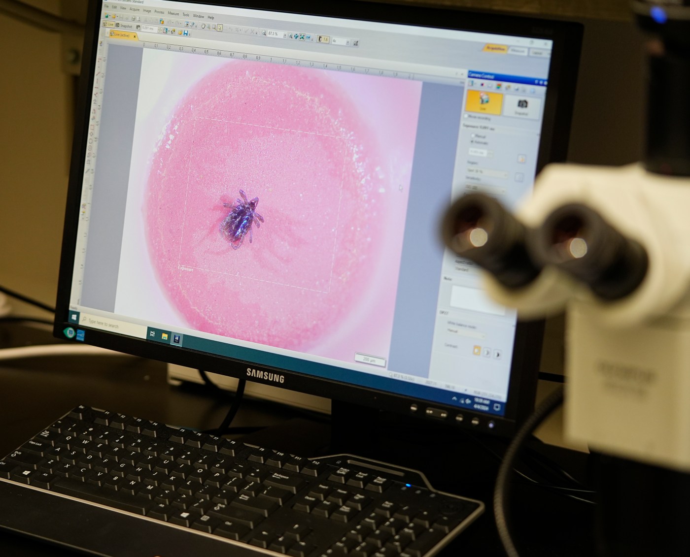 Tick bite ER visits on the upswing in Massachusetts