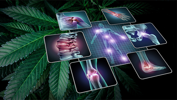 Diagnostic images of shoulder, spine, wrist, knee, ankle, hip, joints and full body scan with highlighted areas over a background of cannabis leaves representing the therapeutic values of cannabis